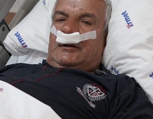 65 yaşındaki adamın burnundan 100 gramlık taş çıkarıldı