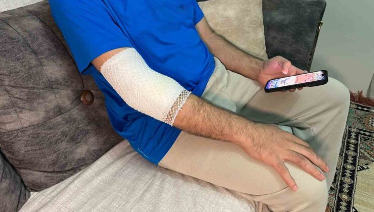 Başakşehir’de sitenin güvenlik görevlisine sahipli köpek saldırdı