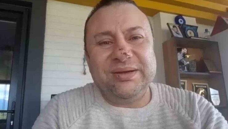 Pitbull saldırısına uğrayan Onur Akay o anları anlattı: “Ben ölümden döndüm”